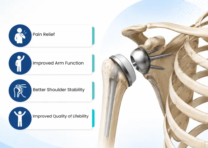 Benefits of Reverse Shoulder Replacement