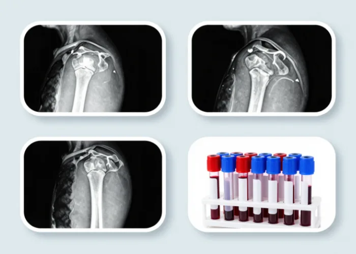 Diagnostic Tests Before Surgery