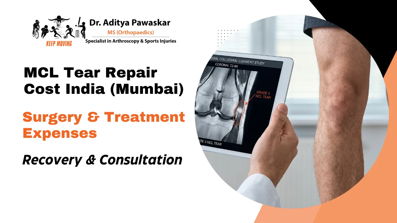 MCL Tear Repair Cost in India (Mumbai & Nationwide): Complete Guide