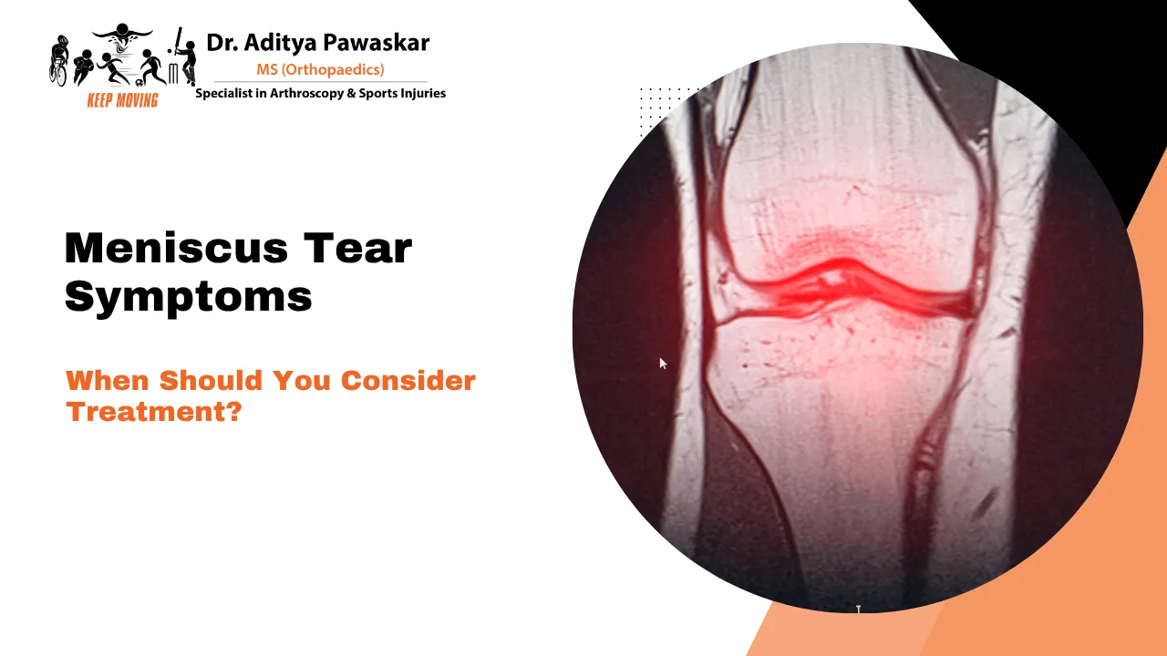 Meniscus Tear Symptoms: When Should You Consider Treatment?