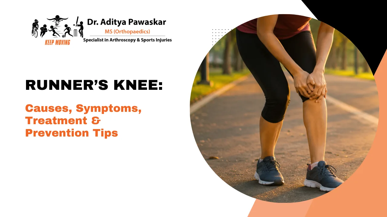 Runner’s Knee: Causes, Symptoms, Treatment and Prevention Tips for Runners