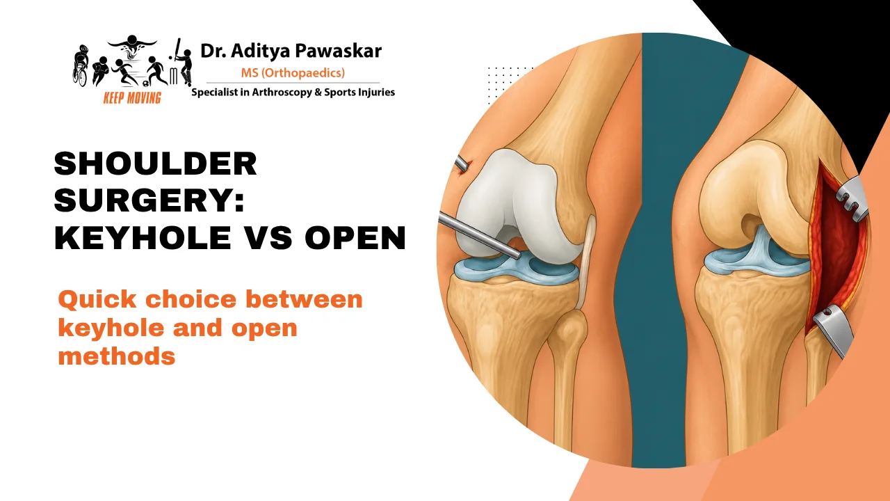 Shoulder Arthroscopy vs Open Surgery: Which Is Better?