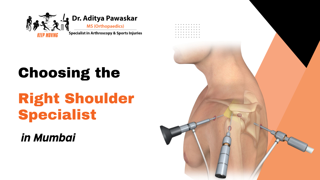 Choosing the Right Shoulder Specialist: Dr. Aditya Pawaskar’s Expertise in Arthroscopic Treatment in Mumbai