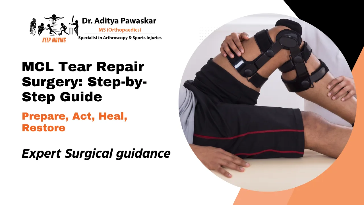 Step-by-Step Guide to MCL Tear Repair Surgery